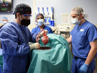 زنوپیوندهای قلبی چقدر دوام آوردند؟