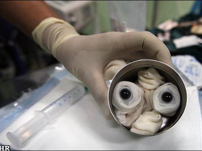 از آزمایشگاه‌های ضدعفونی تا اتاق جراحی  مسیر پرچالش پیوند قرنیه خوک به چشم انسان