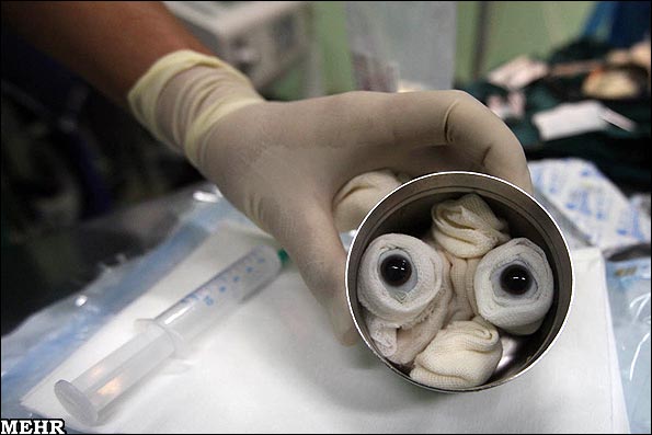 از آزمایشگاه‌های ضدعفونی تا اتاق جراحی  مسیر پرچالش پیوند قرنیه خوک به چشم انسان