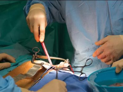 سه دهه تلاش برای پیوند  جزایر لانگرهانس به انسان