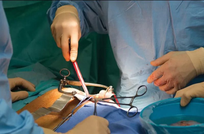 سه دهه تلاش برای پیوند  جزایر لانگرهانس به انسان