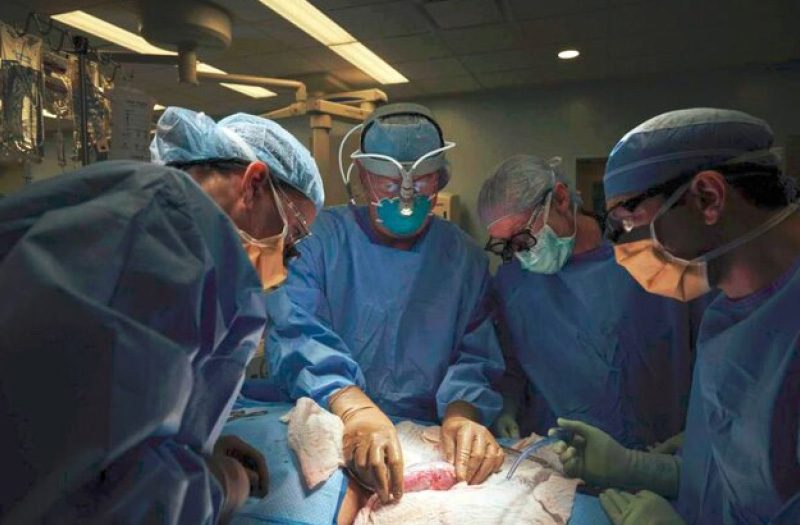 مشارکت جهانی: