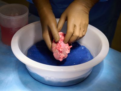 انتقال کلیه حیوانی به انسان با چه مشکلاتی روبرو است؟