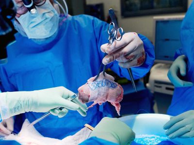 تاریخچه پیوند اعضای حیوان به انسان